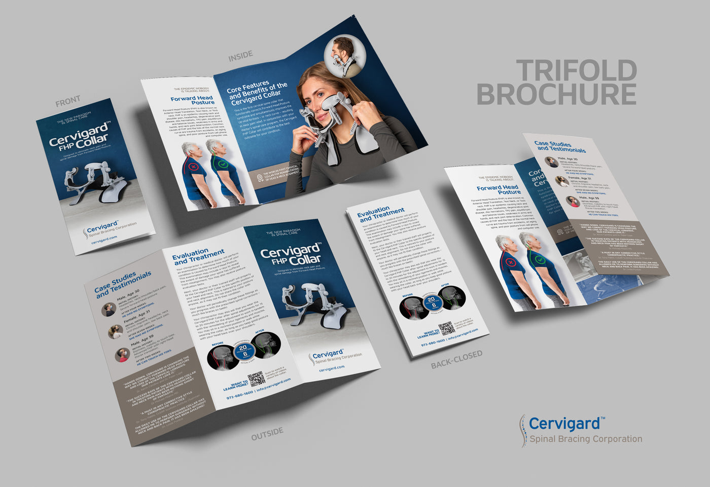 Cervigard™ Trifold brochures