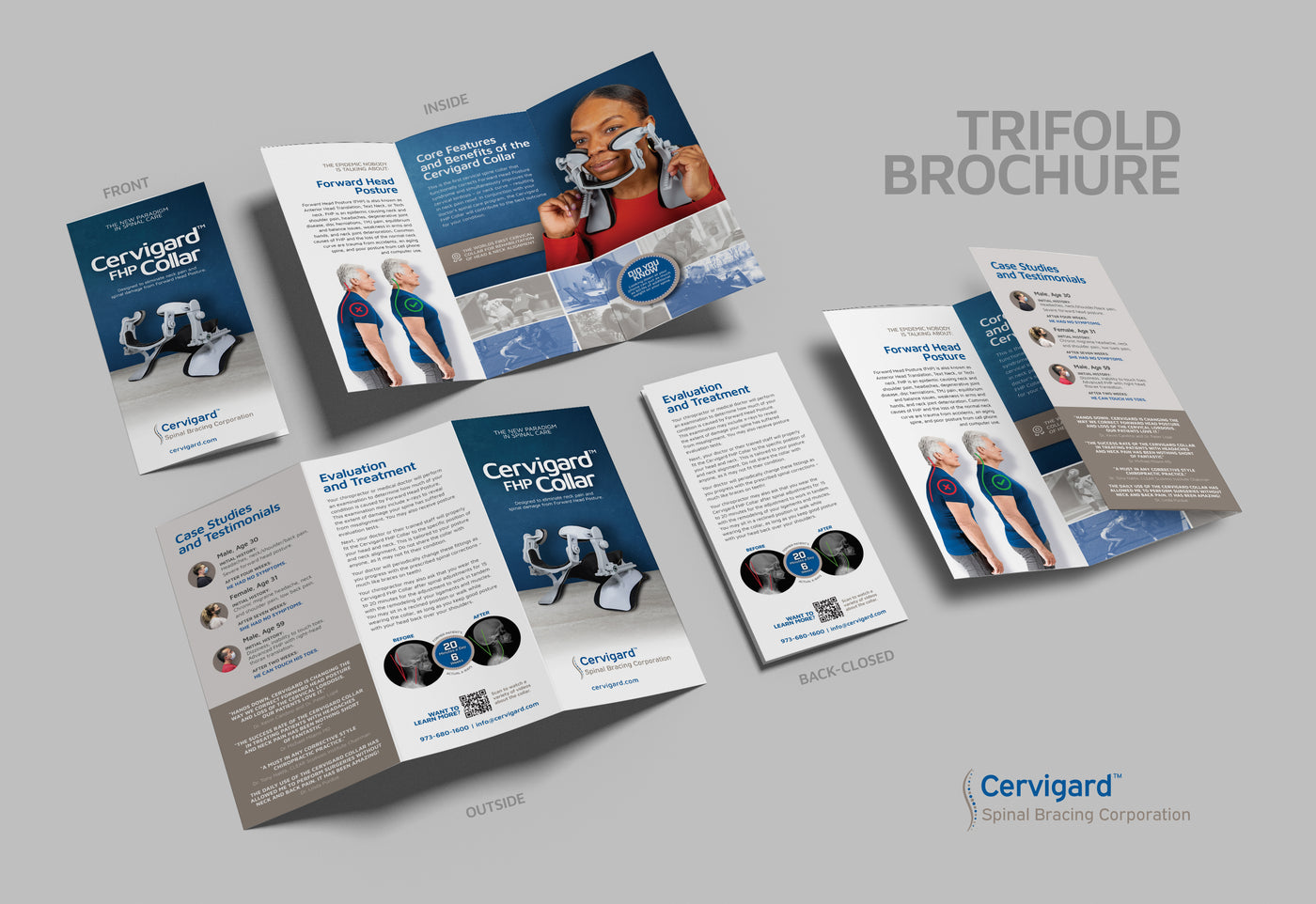 Cervigard™ Trifold brochures